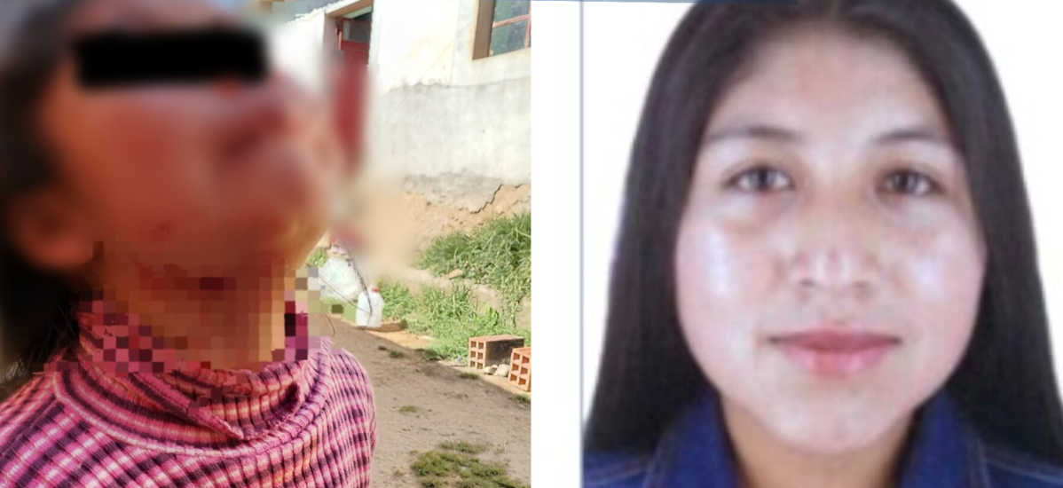 Puno | Imputada por presunta agresión a niña falta a diligencia clave en investigación fiscal Puno | Imputada por presunta agresión a niña falta a diligencia clave en investigación fiscal